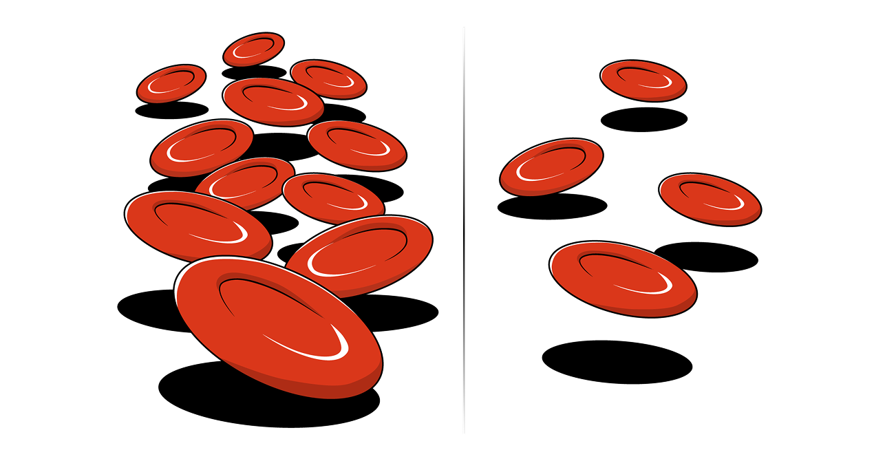 Step 5: Show the motion of the PNH red blood cell bursting, with red contents coming out of it